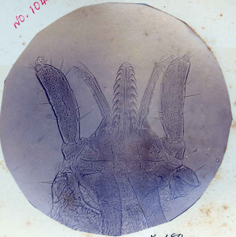 Scrub Tick through microscope 180X