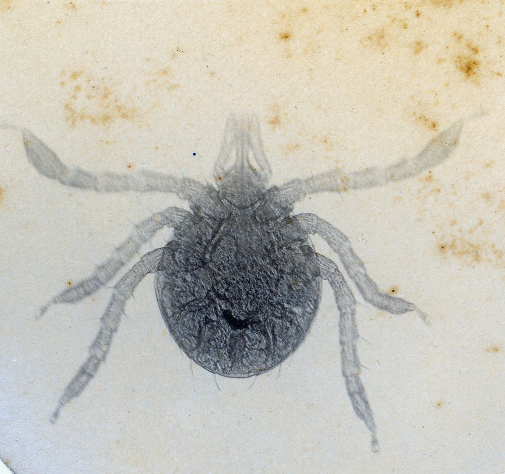 Scrub Tick through microscope 70X